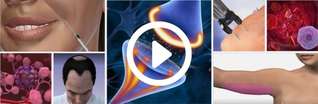 montagem com fotos de trechos dos videos