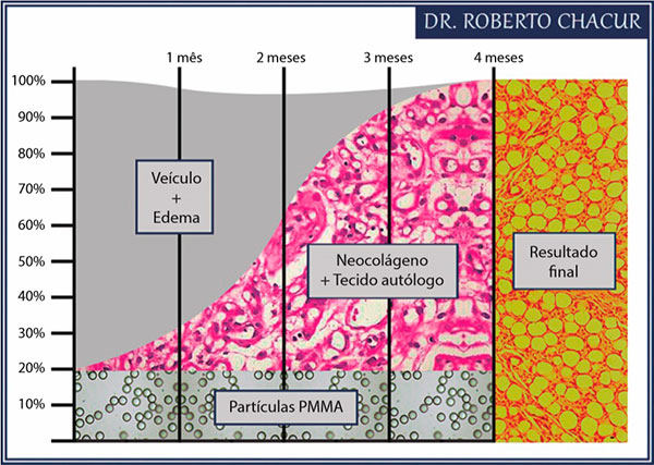 grafico da estimulação de tecido e colágeno pelo pmma ao longo do tempo