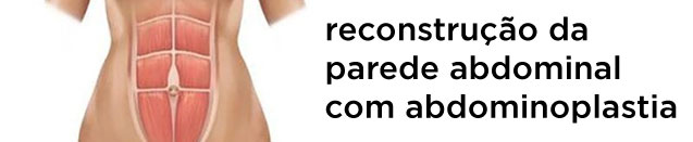 reconstrução da parede abdominal com abdominoplastia para aproximar os músculos que sofreram dilatação