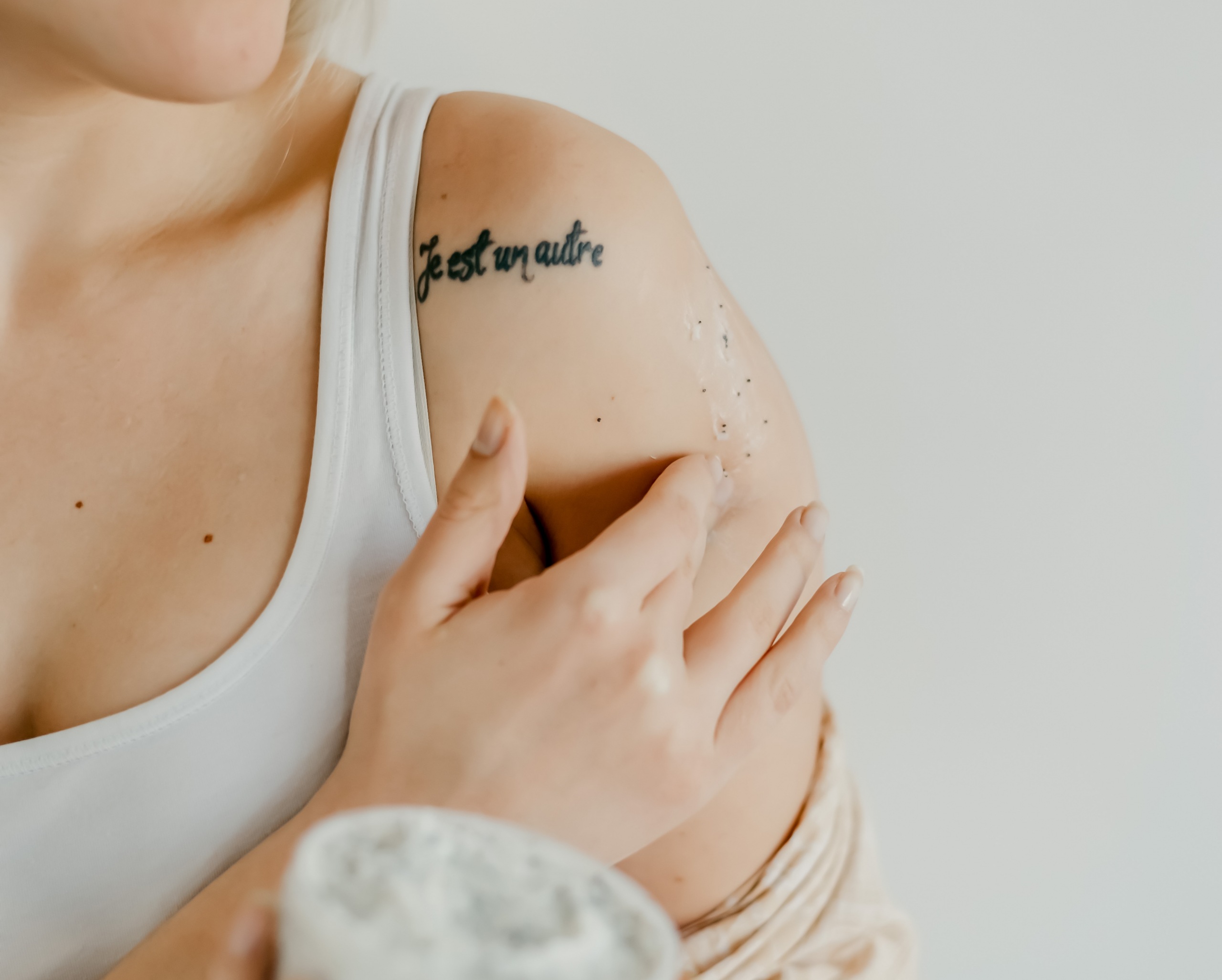 Tratamento com laser Nd:Yag para Remoção de Tatuagem