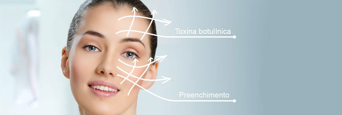 rosto de mulher jovem em fundo verde agua com indicação de que a toxina botulínica é realizada no terço superior do rosto e o preenchimento nos terços médio e inferior