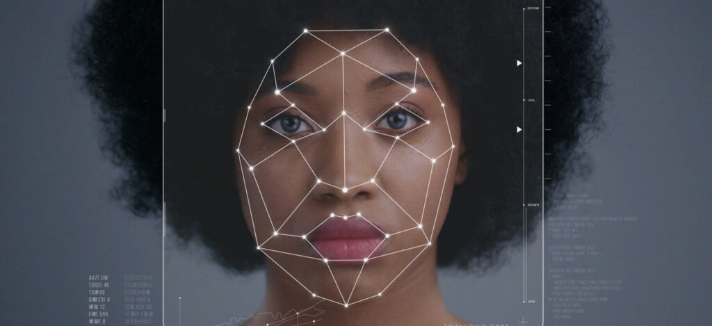 mulher com um série de pontos no rosto interligados por linha demarcam as referencias para realização da harmonização facial