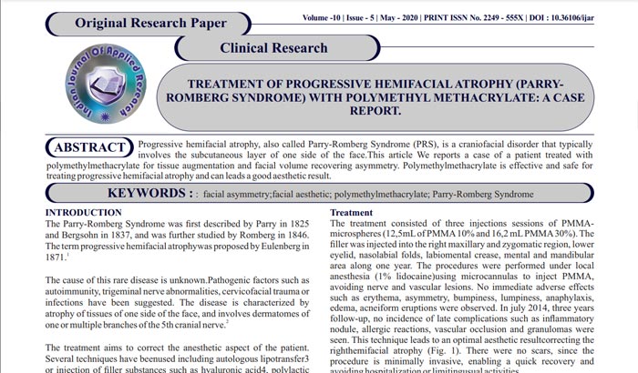 parte superior apenas texto contido na primeira pagina do artigo sobre tratamento da Síndrome de Parry Romberg com PMMA