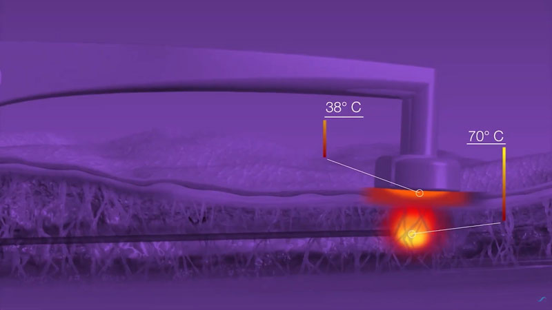 bodytite com diferentes temperaturas para tratamento da flacidez corporal